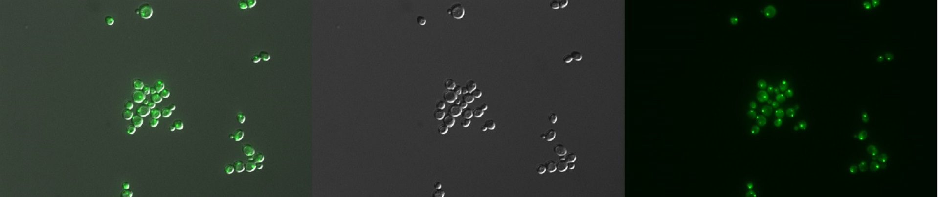 Yeast